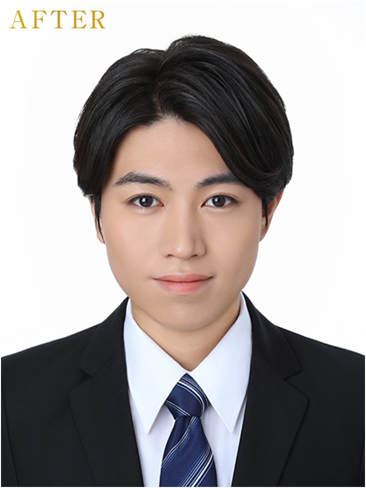 after
